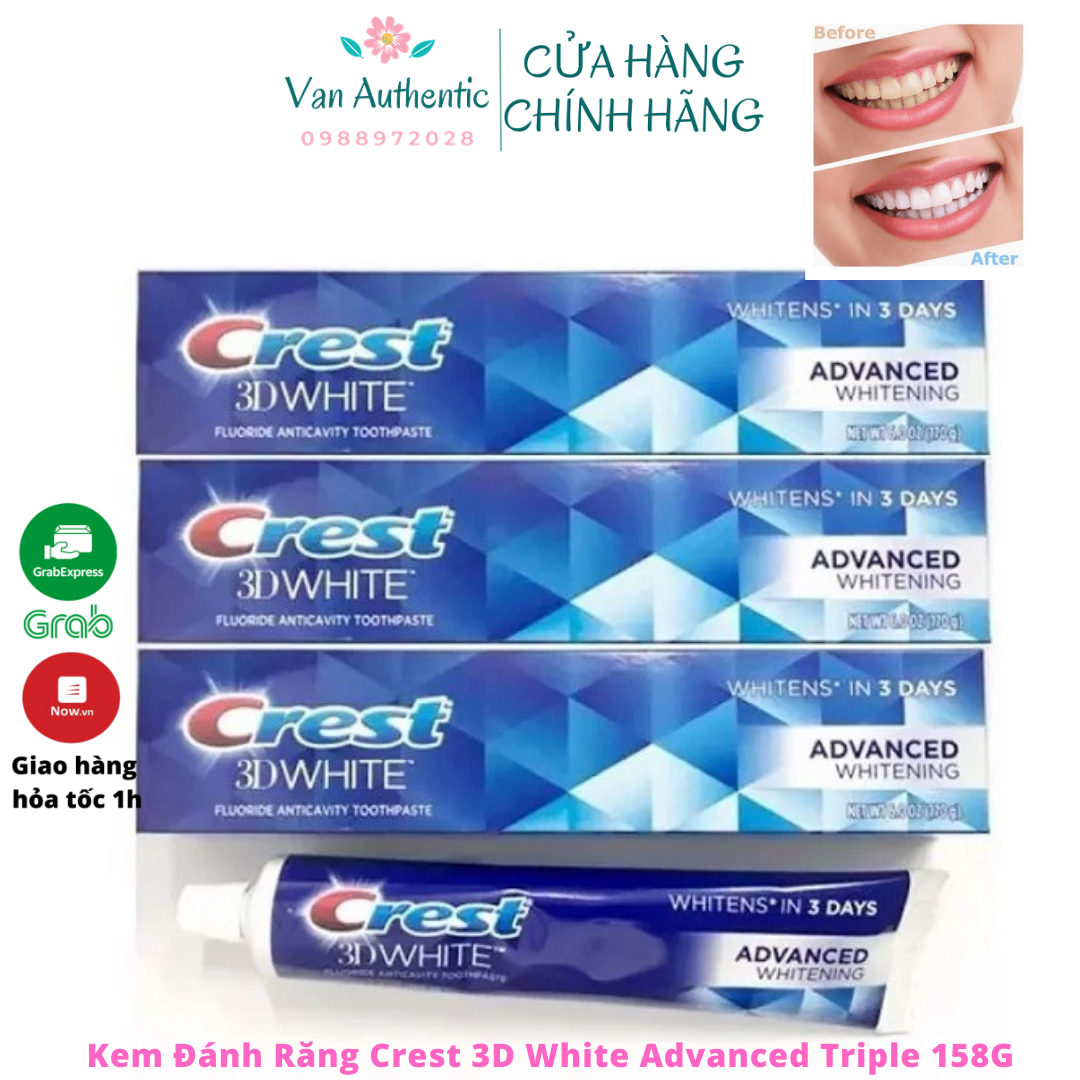 Kem đánh răng Crest 3D White Advanced Whitening 147g