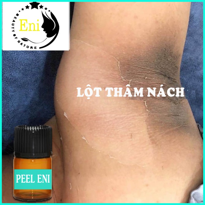 Peel lột da nách hết thâm trắng mịn