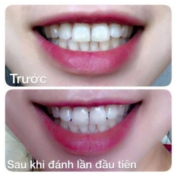 Kem Đánh Sạch Trắng Răng Eucryl Toothpaste
