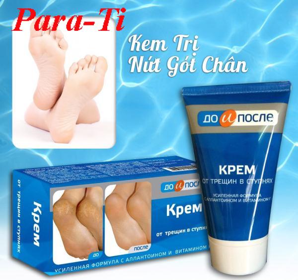 Kem chống nứt nẻ gót chân kpem - nga