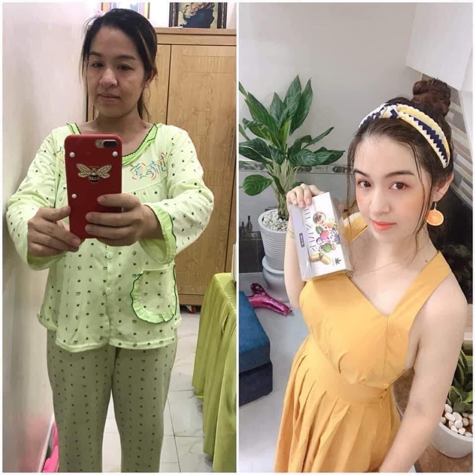 Giảm cân Nâng cơ mông SLIM and FIT [Chính Hãng]