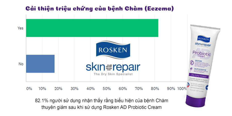 Kem chăm sóc da chàm sữa Rosken AD Probiotic 400ml