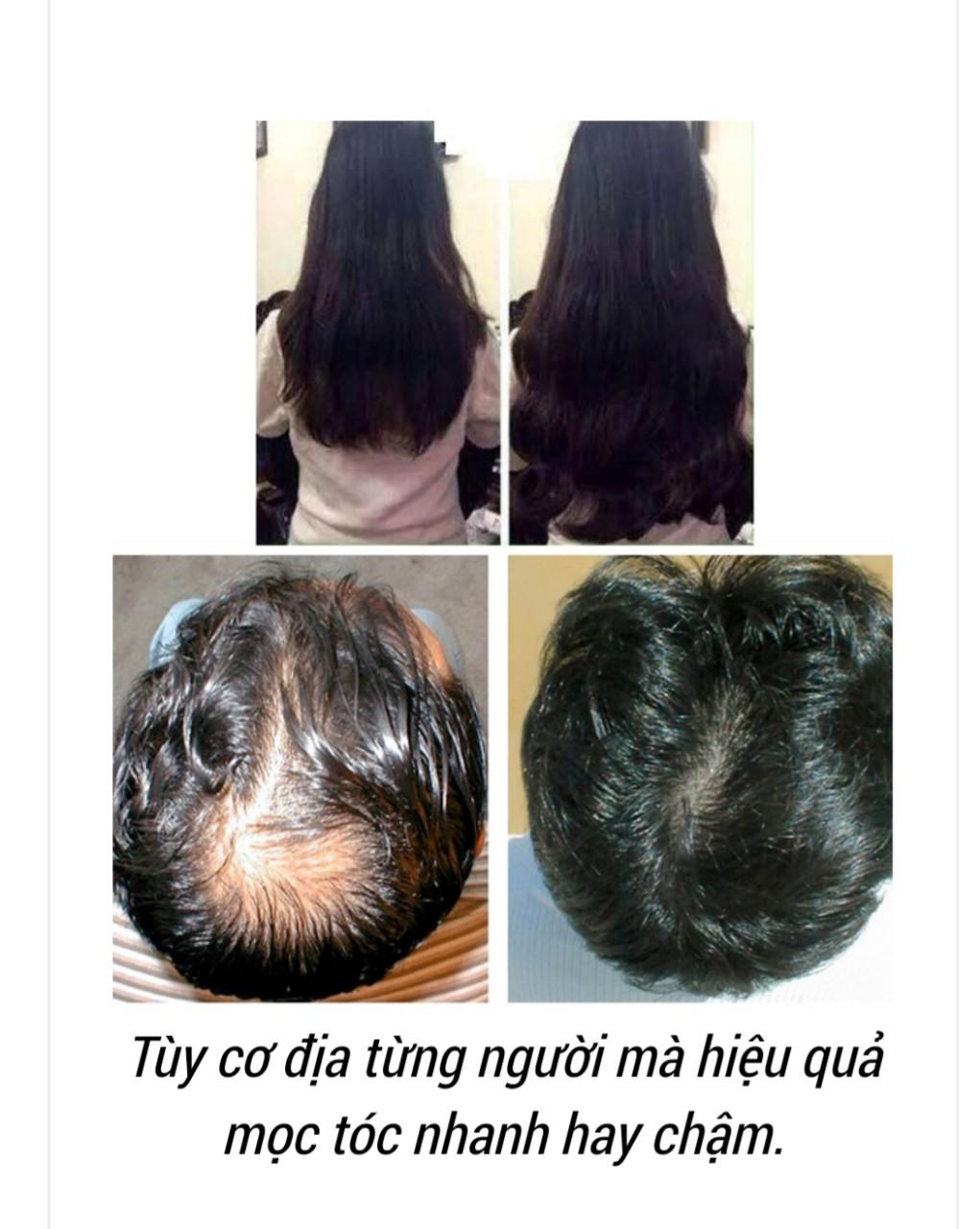 [HCM]Dầu Gội Chống Rụng Tóc Biotin Collagen 385ml