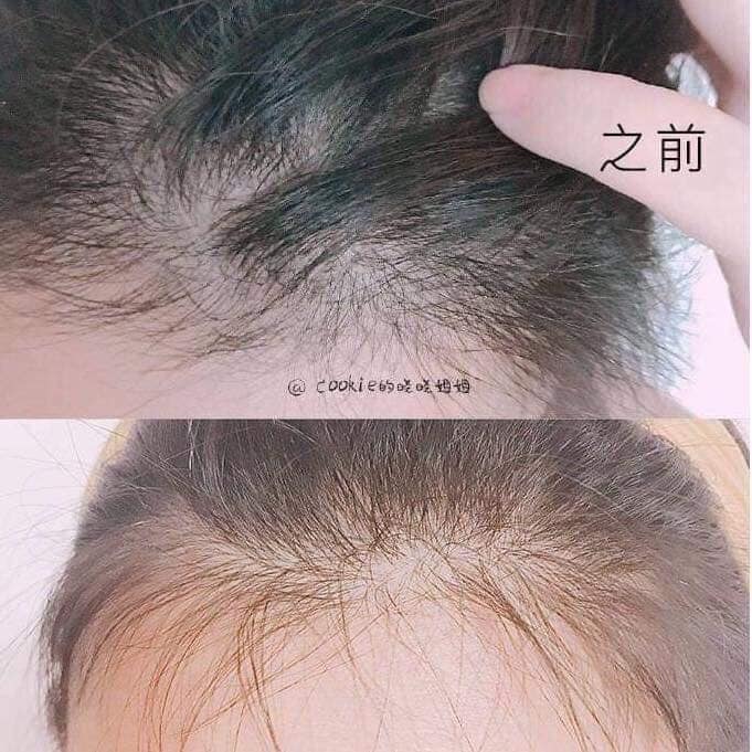 Bộ Dầu gội xã BIOTIN mỹ
