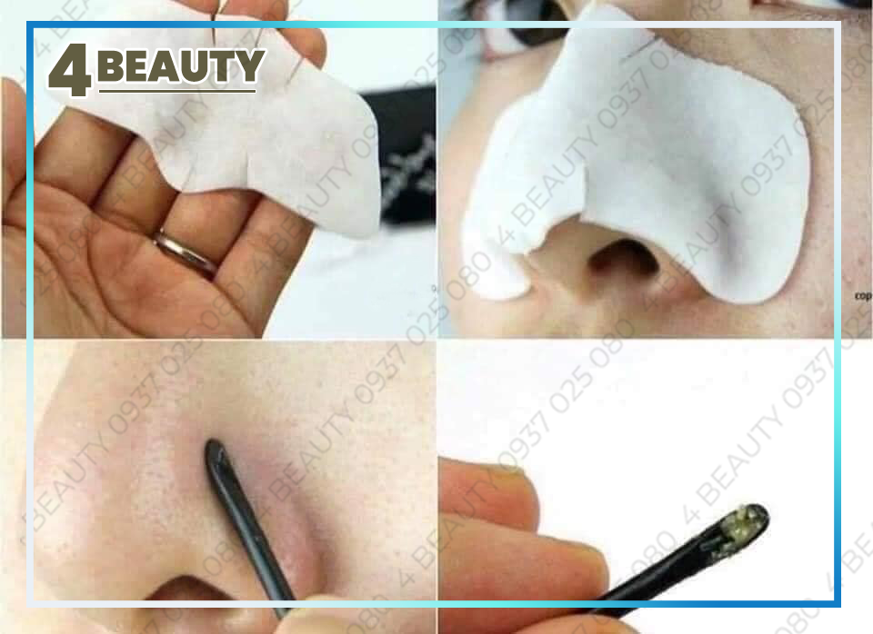 Miếng Dán Mụn Đầu Đen Goodbye Black Head Ciracle