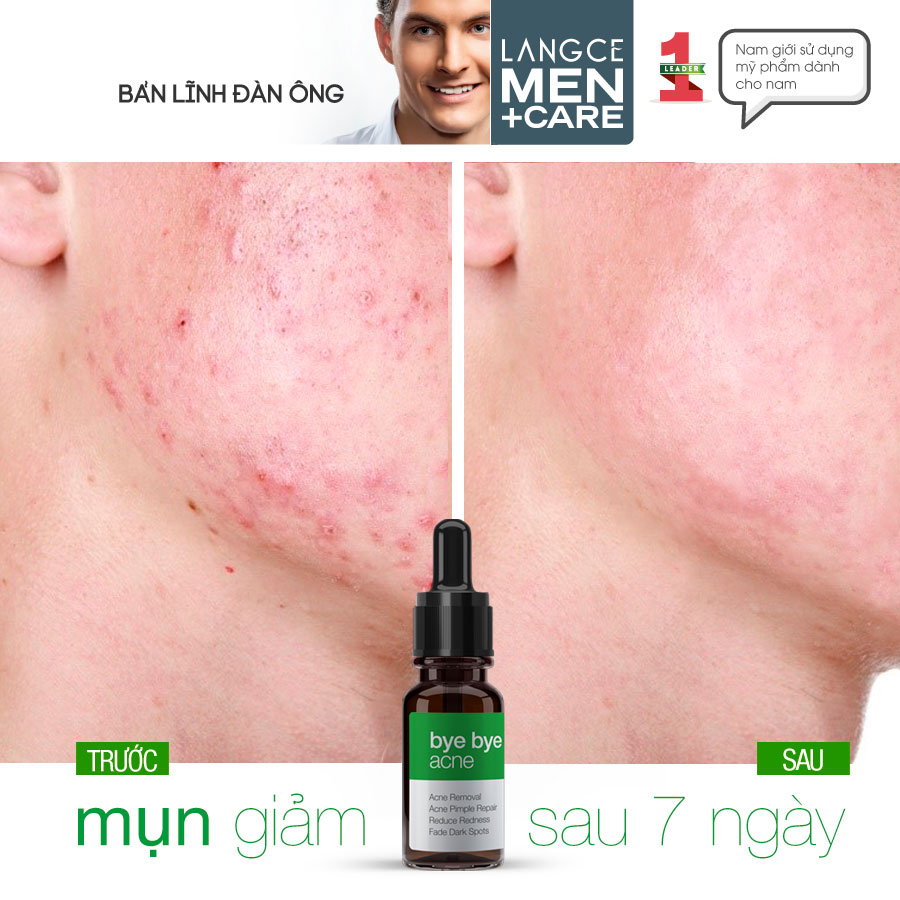 LANGCE Serum Total Beauty Collagen+ Bye Bye Acne 10ml