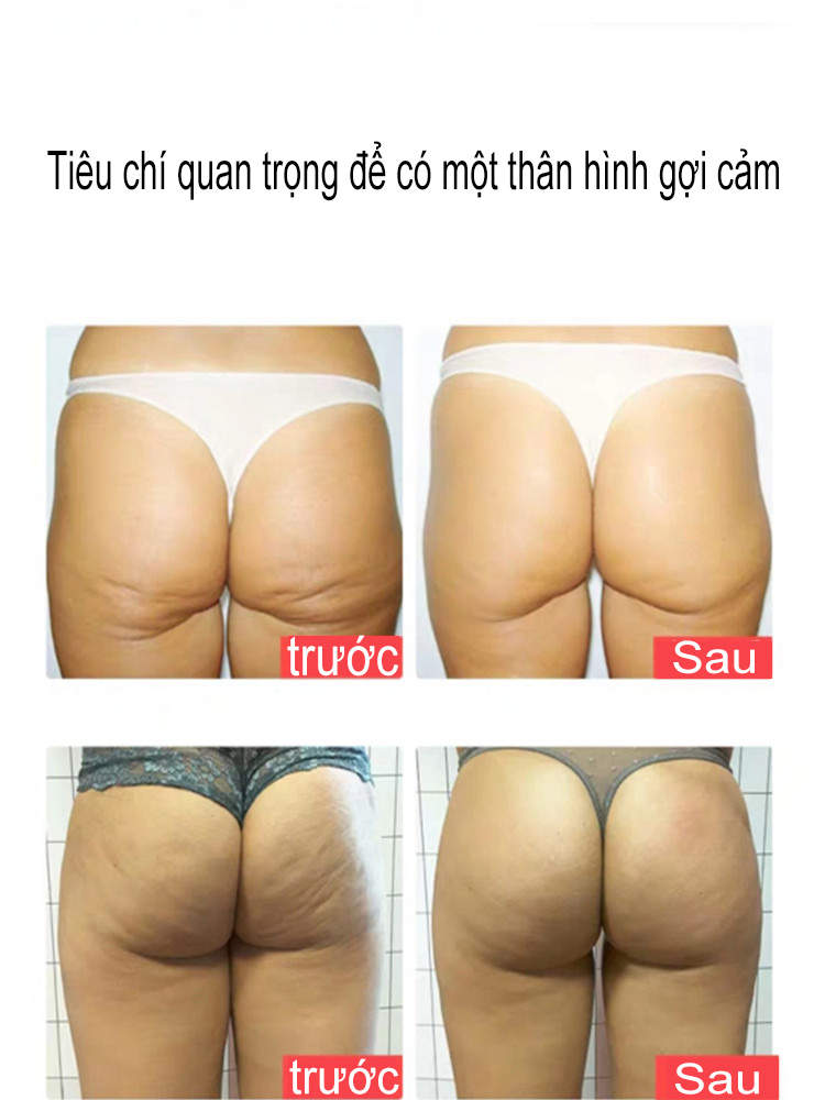 HỊP LIFT UP Tăng Mông Làm Săn Chắc Mông
