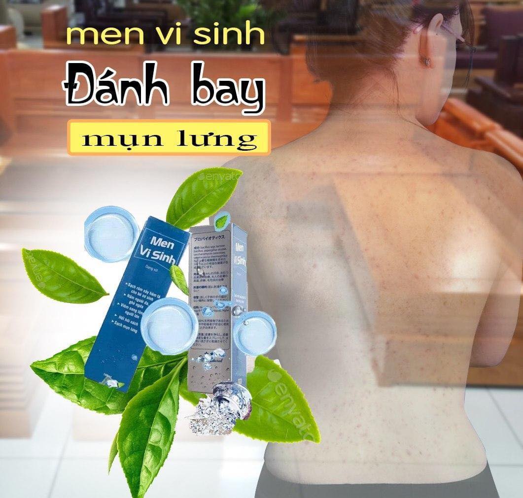 Mụn Lưng Mụn Ngực Men Vi Sinh Tavida