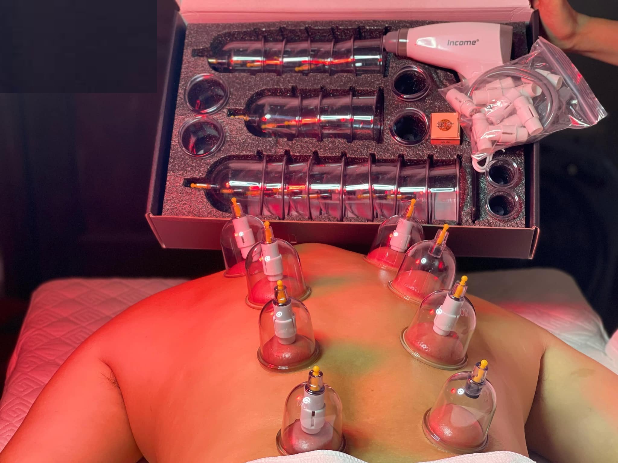 Bộ Giác Hơi Không Dùng Lửa 24 Cốc Massage Chăm Sóc Cơ Thể