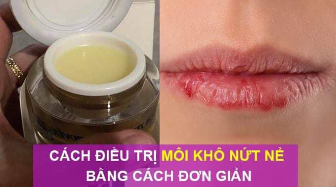 Kem chống lão hóa và làm đẹp da Bách Hoa Linh