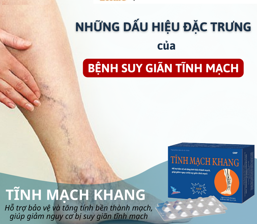 Tĩnh Mạch Khang