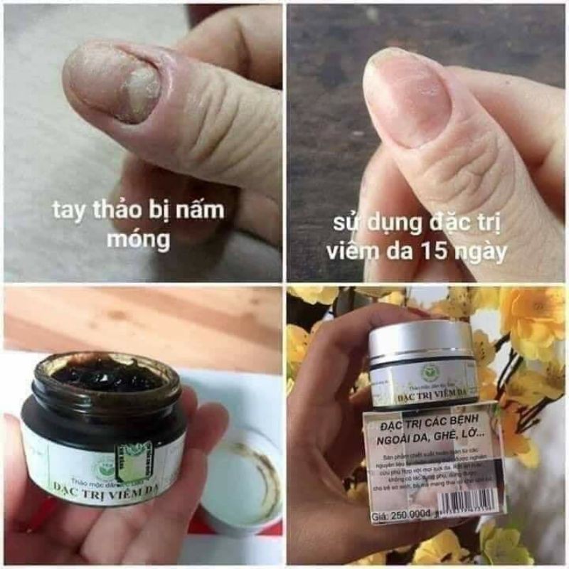 THẢO MỘC BÔI DA THIÊN NHIÊN TKH