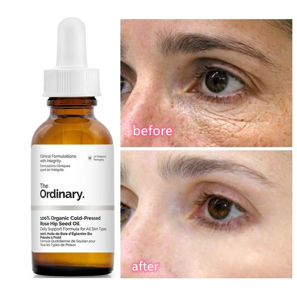 Serum giảm thâm bọng mắt The Ordinary Caffeine Solution 5% + Egcg 30ml