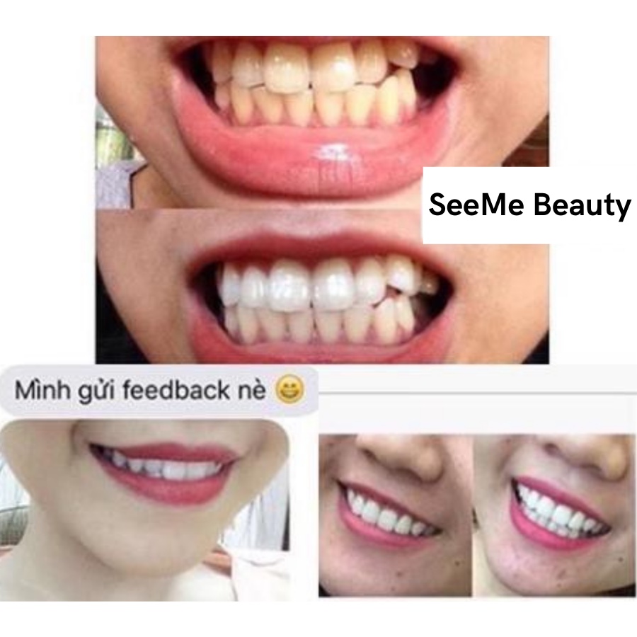 Miếng dán trắng răng Crest 3D White - Mỹ (Professional Effects/ Supreme Flexfit/ Glamorous/ 1 hour) Seeme Beauty