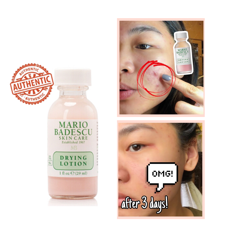 [29ml + Bill] Chấm Mụn Mario Badescu Drying Lotion