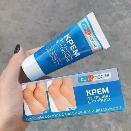 Kem xóa nứt nẻ, dưỡng gót chân Apteka Nga
