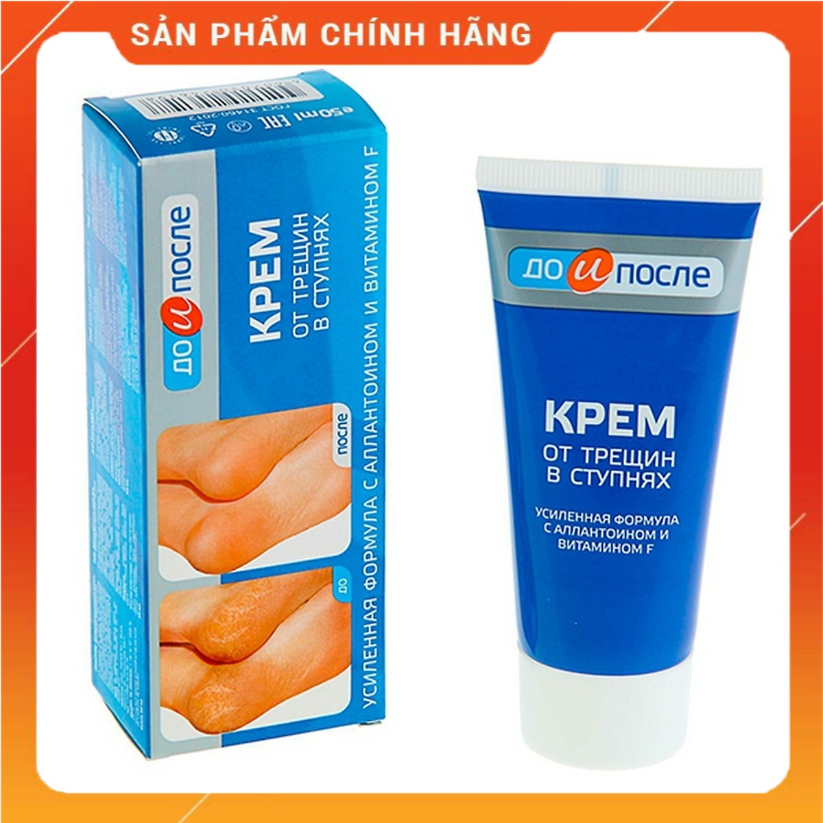 Kem Nứt Gót Chân Kpem Apteka 50ml Nga Giảm Nứt Gót Chân , Giữ Ẩm Da , Nhanh Kéo Da Non Gót Chân