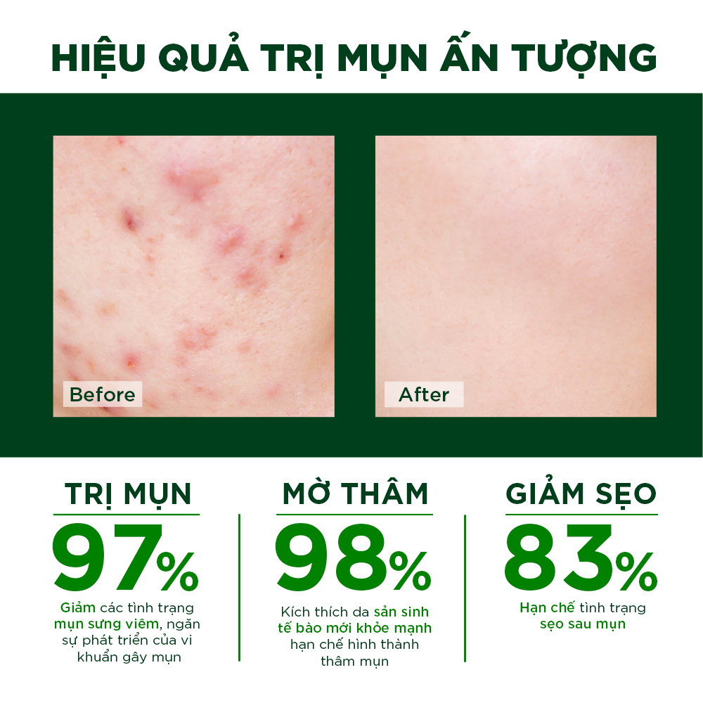 Bộ đôi cấp ẩm làm sạch dịu nhẹ phù hợp da mụn nhạy cảm Oribe Soft Touch (Gel rửa mặt 100gr + Nước hoa hồng 150ml)