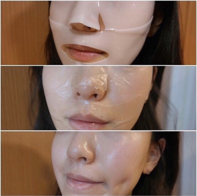 Mặt nạ DermMatrix hút mụn cám bã nhờn