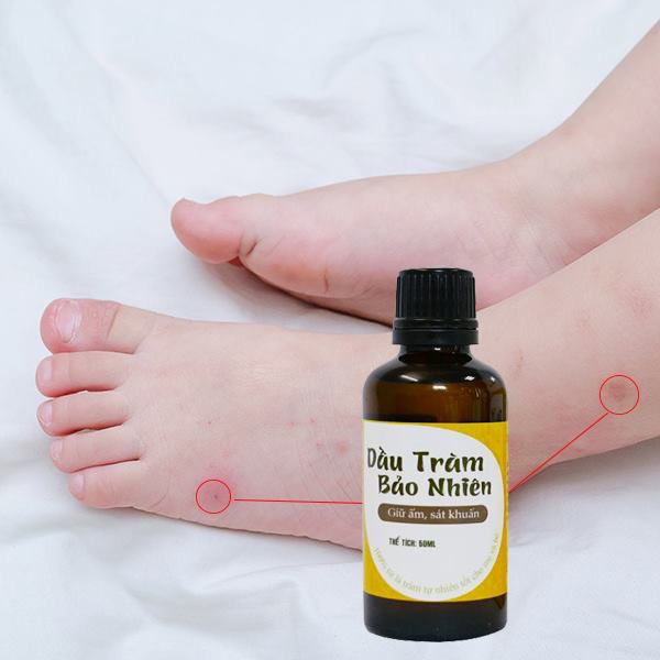 Tinh dầu tràm nguyên chất cung đình cho bé