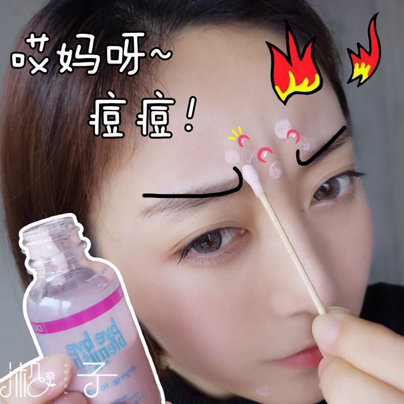[HCM]Bye Bye Blemish For Acne Drying Lotion Giảm Mụn