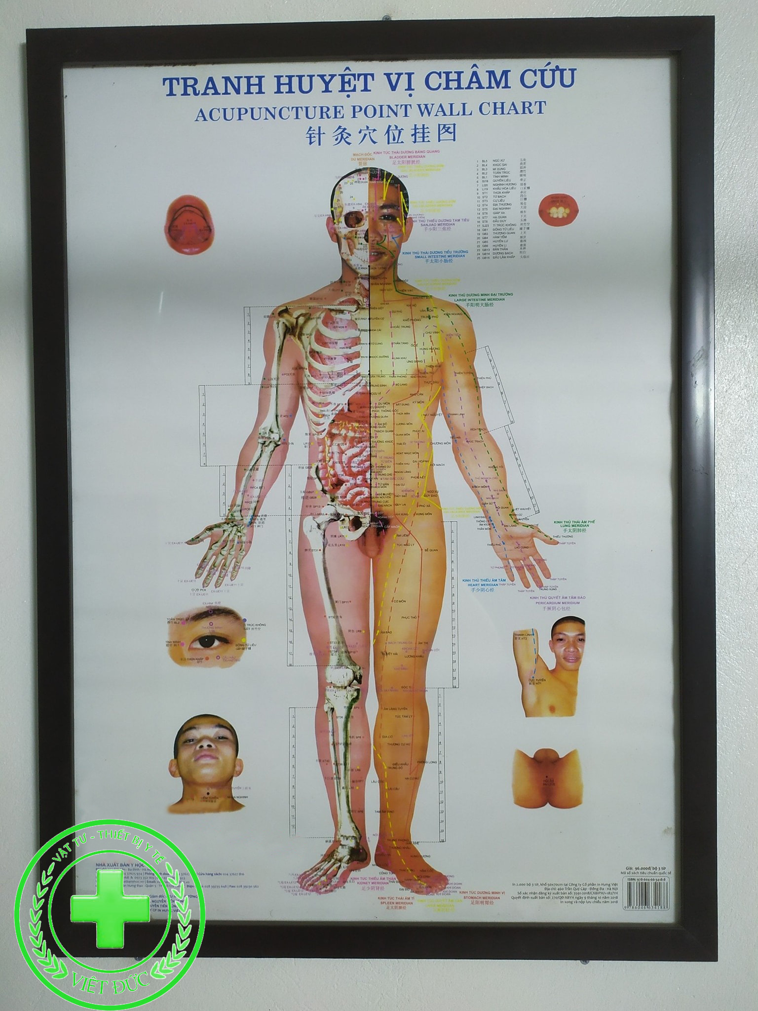 Tranh châm cứu huyệt vị