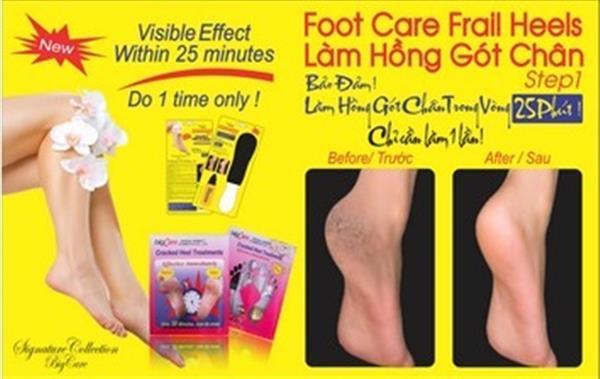 Làm Hồng Gót Chân