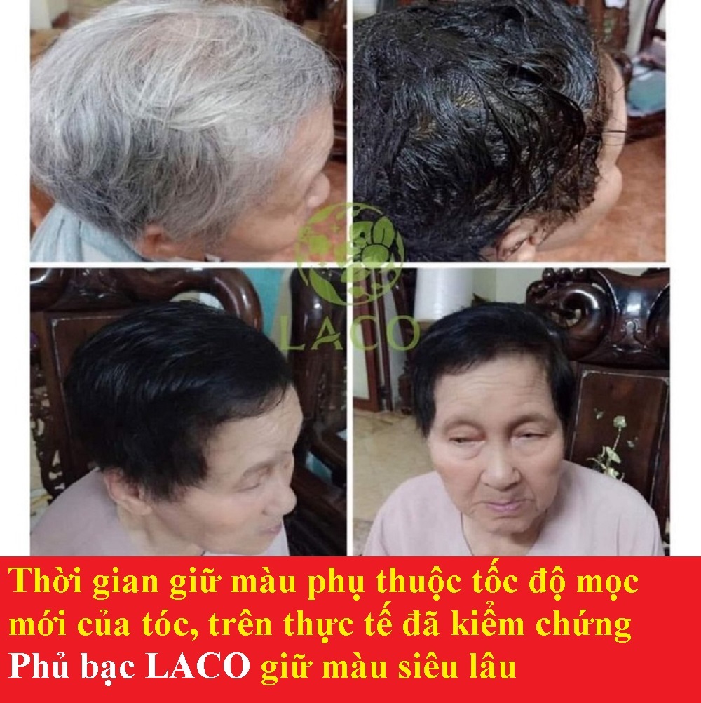 COMBO BLACK 3P & Dầu gội phủ bạc laco black hair 200ml [date 2025]