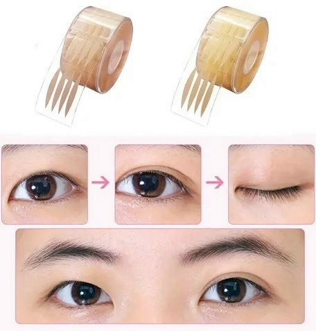 Kích mí cuộn dạng lưới Eyelid Malian