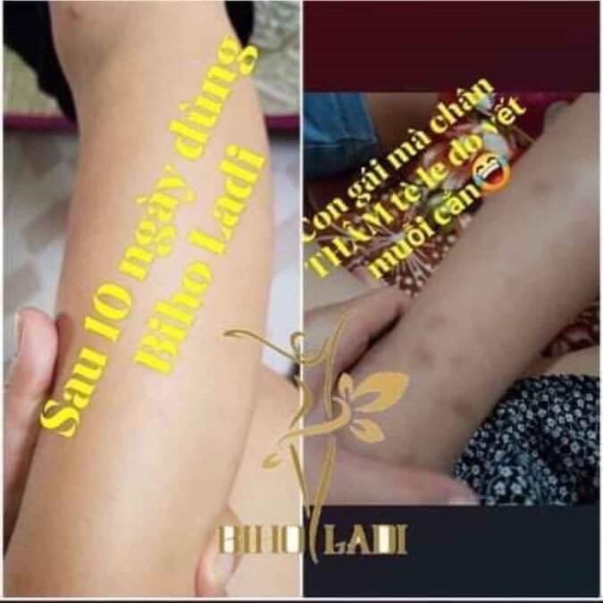 [HCM][HÀNG CHÍNH HÃNG] Kem Siêu Dưỡng Thâm 5S Biho Ladi