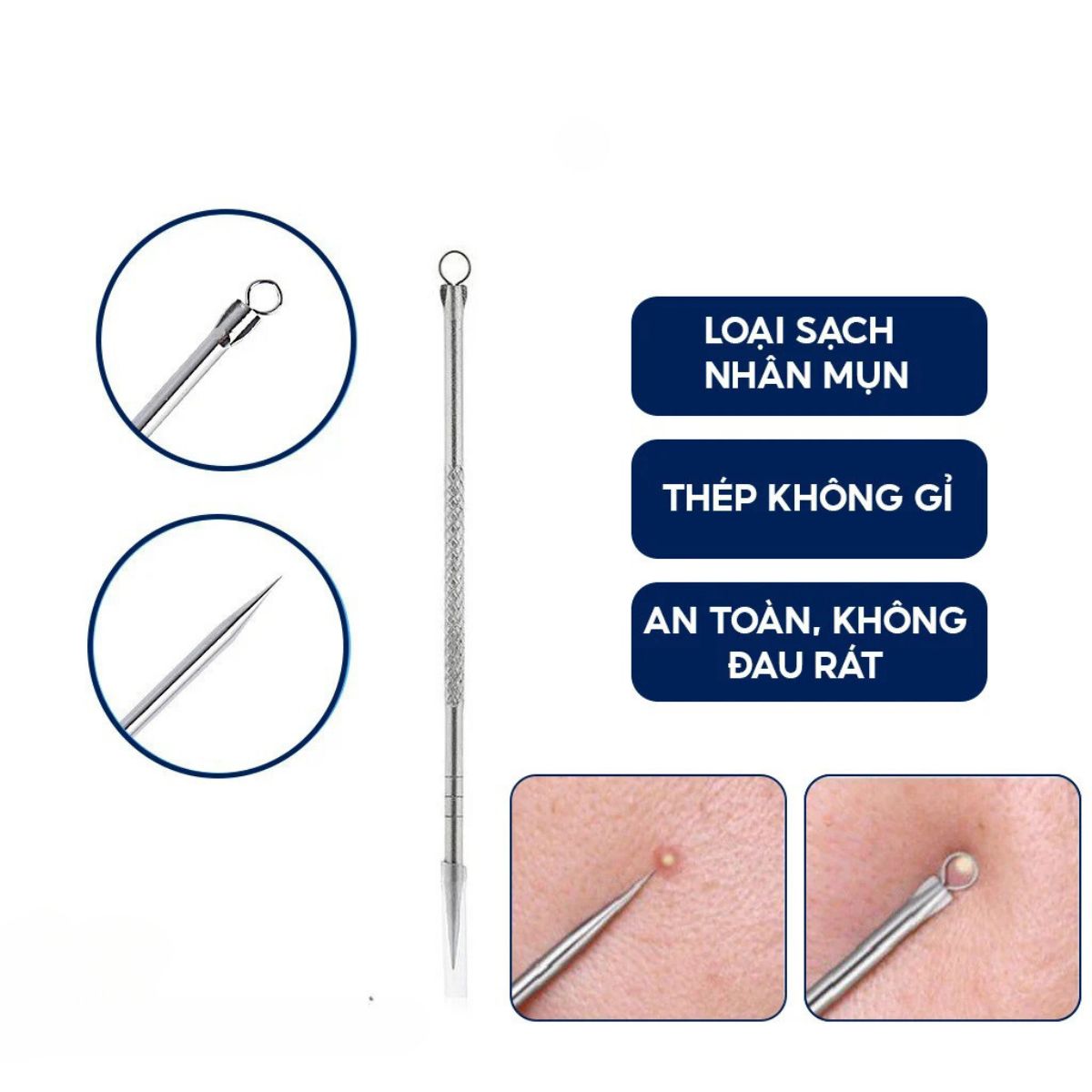 Cây nặn mụn, que nặn mụn chuyên dụng không gỉ