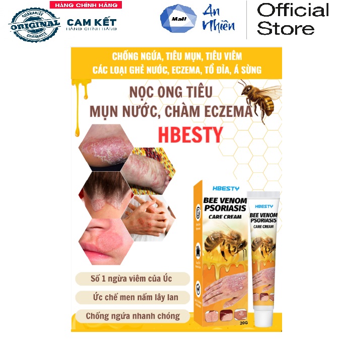 Kem bôi nọc ong hbesty tiêu mụn nước - chàm eczema - giảm tổ đỉa - á sùng - viêm nấm hiệu quả