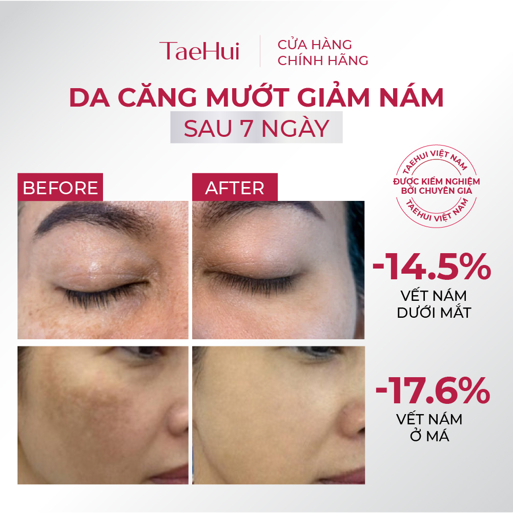Taehui - Serum nám - Serum Gii - 30 ml