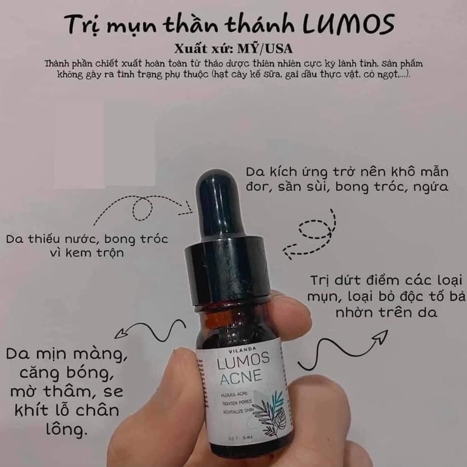 Serum Lumos Ance Hàng chuẩn check Code, date mới