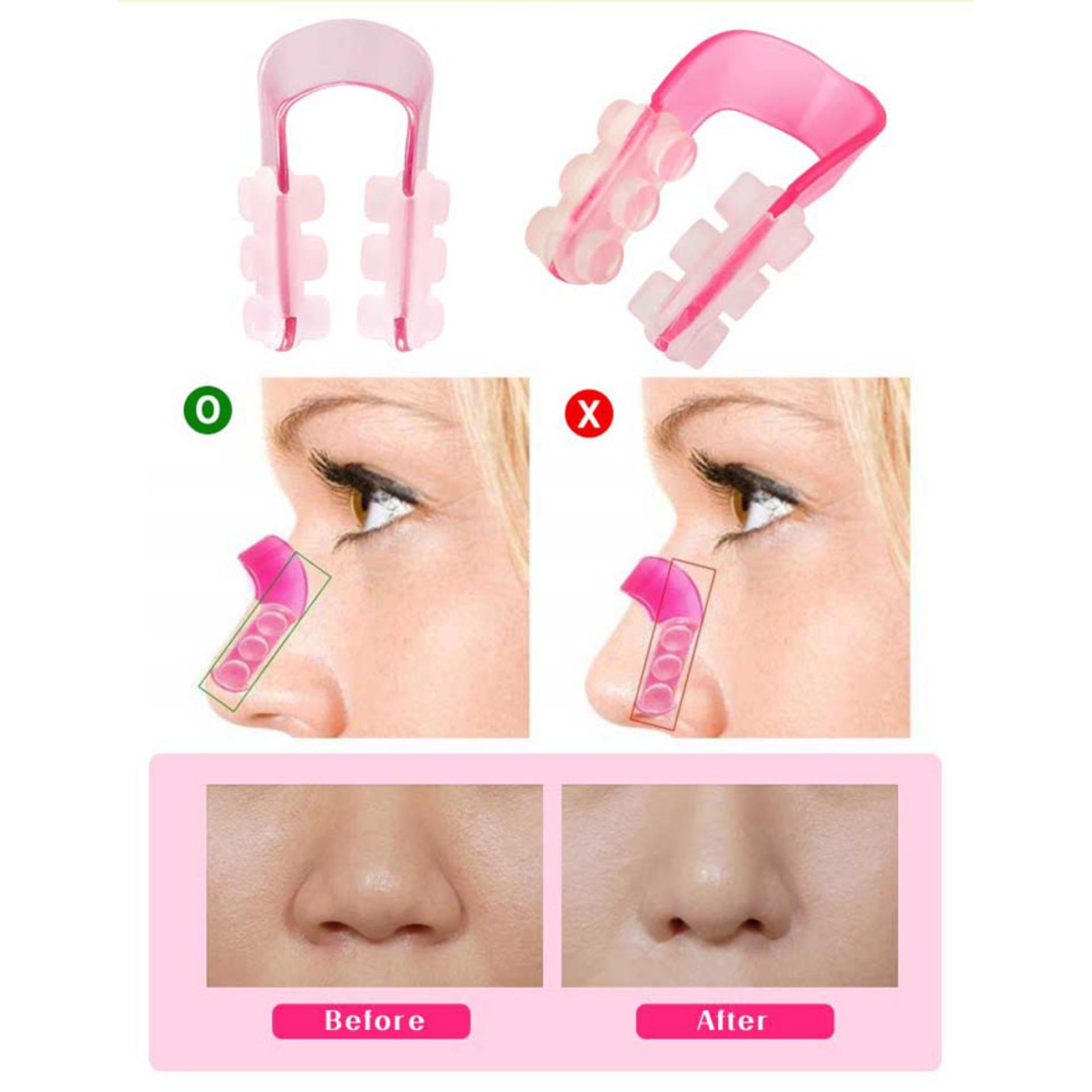 Combo 2 Kẹp nâng mũi Nose up