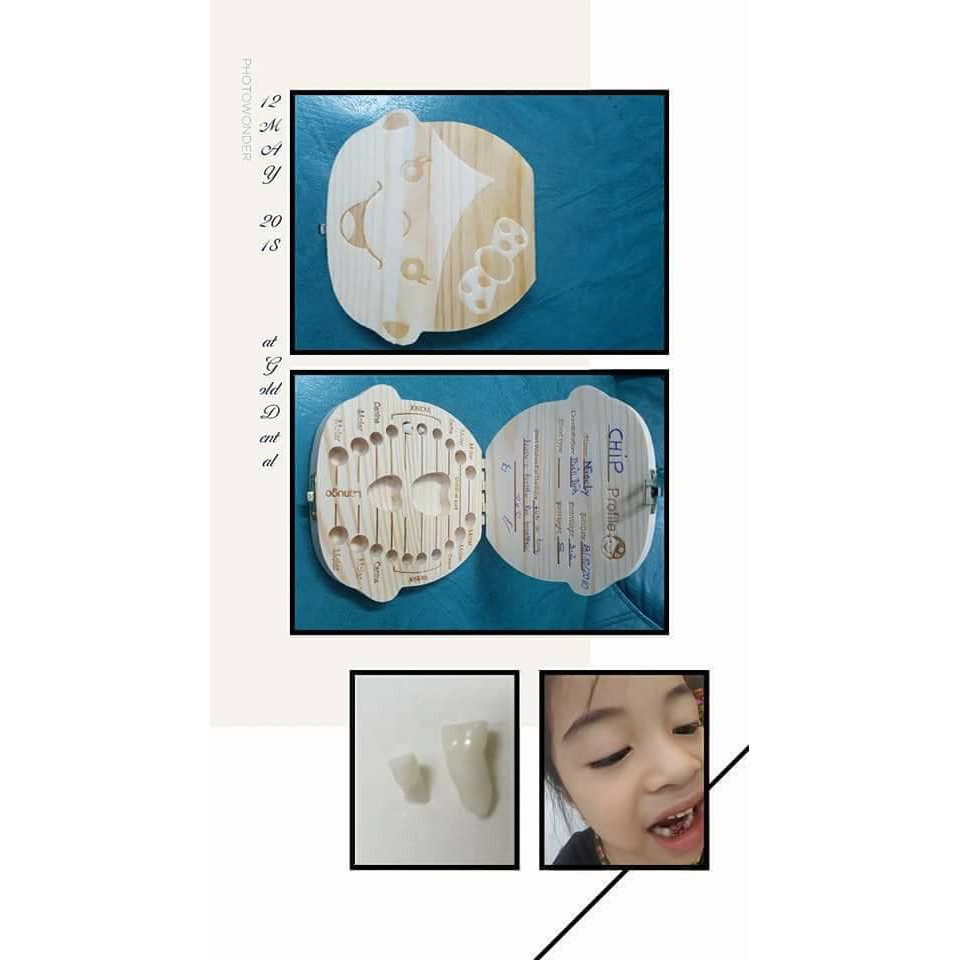 Hộp đựng răng sữa kỉ niệm cho mẹ và bé