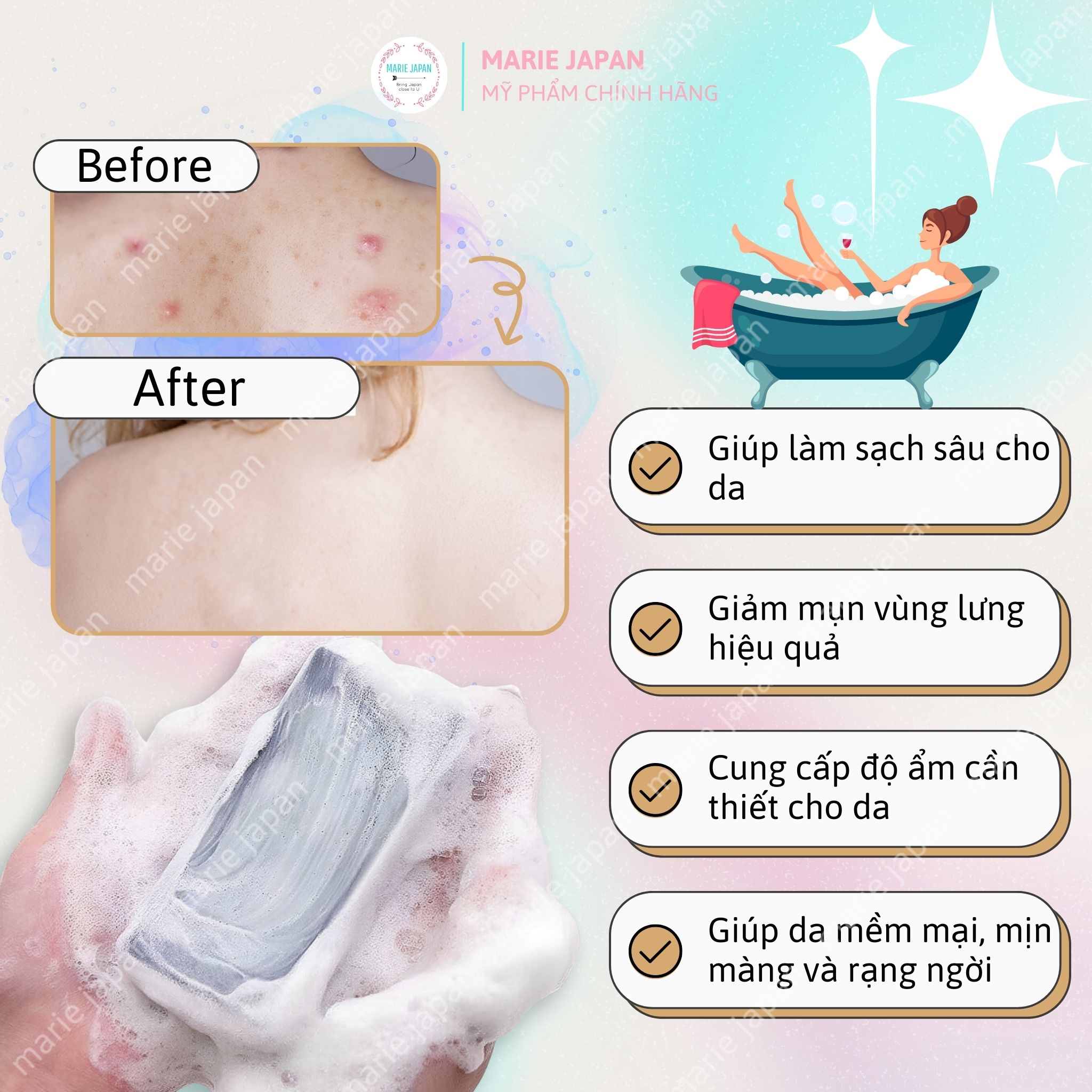 [CHE TÊN] Xà Phòng Giảm Mụn Lưng For Back  Nhật Bản