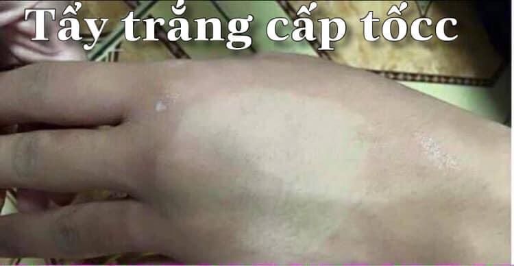 Bộ kem tắm trắng cơ thể