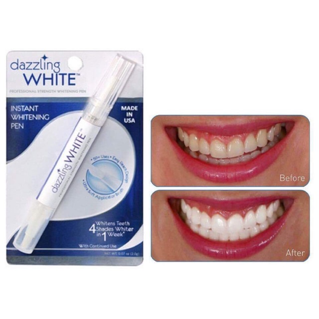 [HCM]Bút tẩy trắng răng Dazzling White