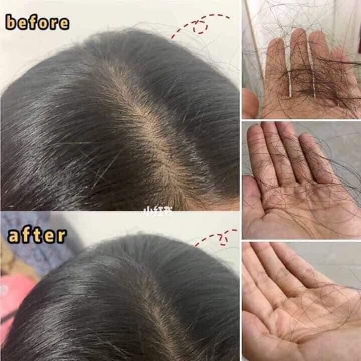 Tinh Chất Kích Thích Mọc Tóc Thảo Dược SATO Nhật Bản - 30ml