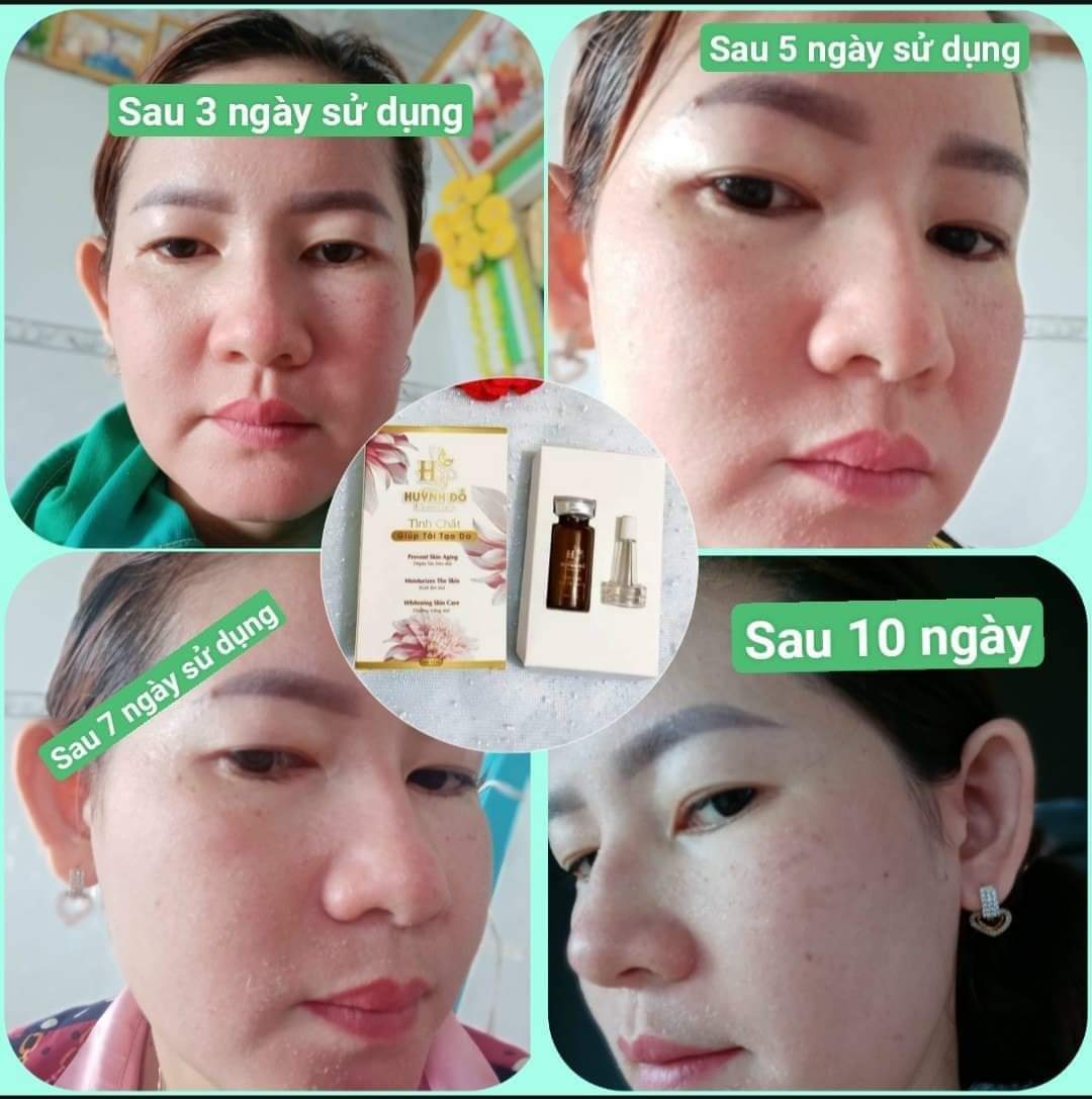 Tinh chất tái tạo da HUỲNH ĐỖ