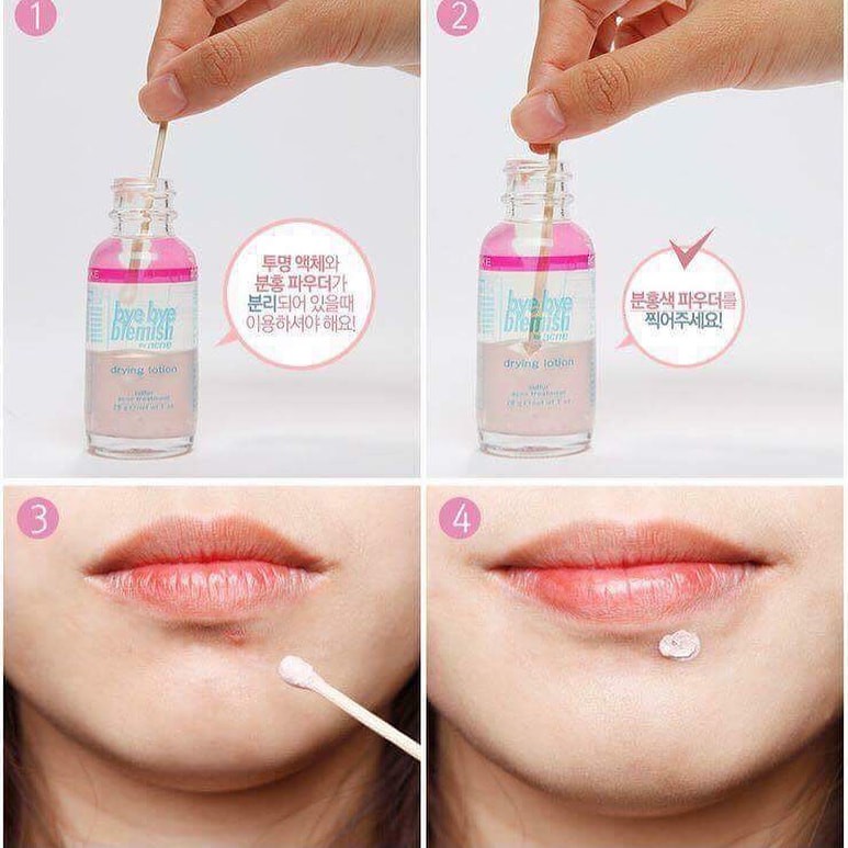 Chấm  mụn khẩn cấp Bye bye blemish