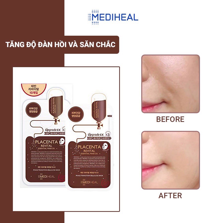 Mặt Nạ Mediheal Essential Mask 25ml