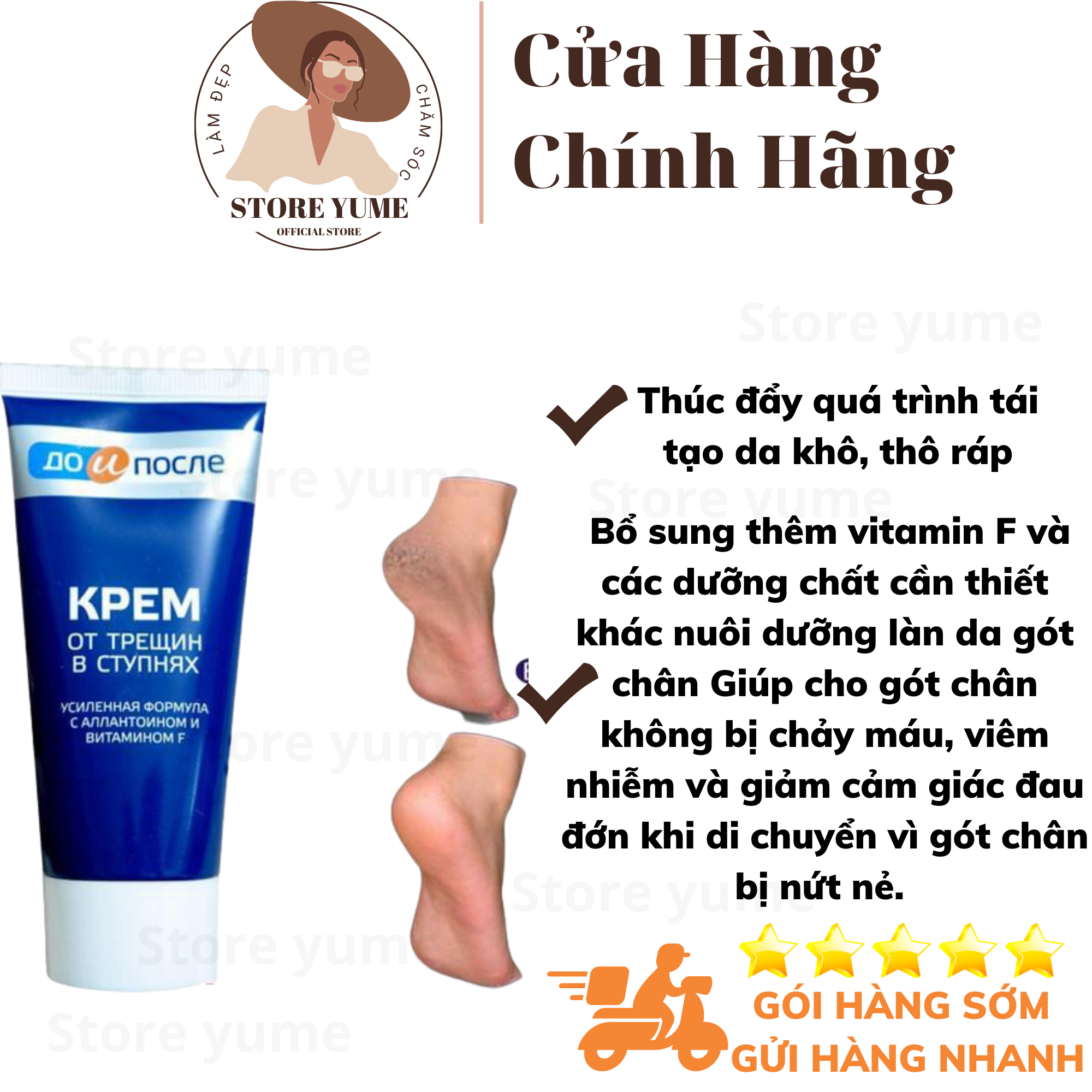Kem tri. nứt gót chân Nga Kpem giúp dưỡng ẩm, làm mềm da chân
