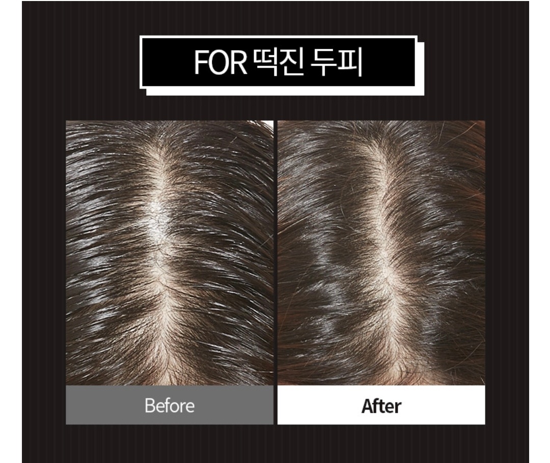 [Nhacuabeautyholic] Phấn hút dầu tóc APIEU OILY HAIR DRY POWDER