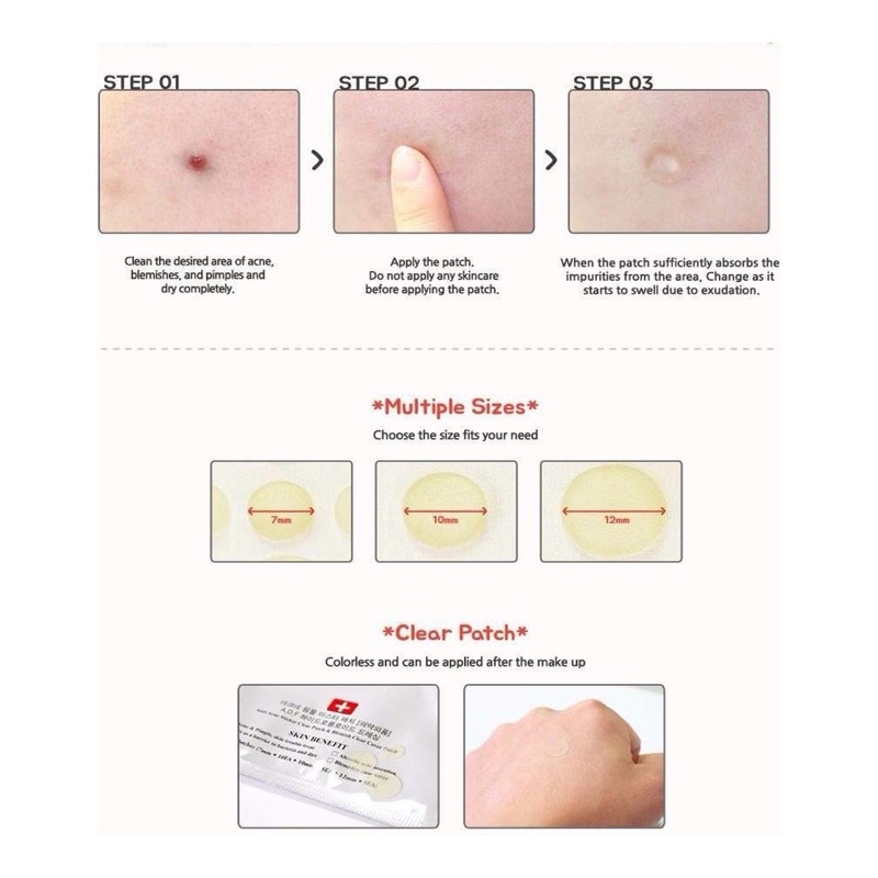 Miếng Dán Mụn Cosrx Acne Pimple Master Patch