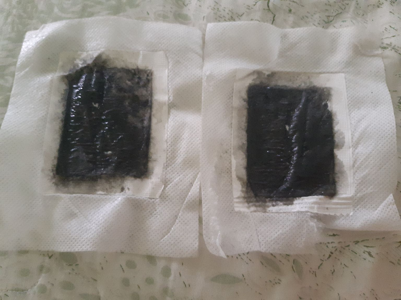combo 5hộp dermax relax thải độc giam cân