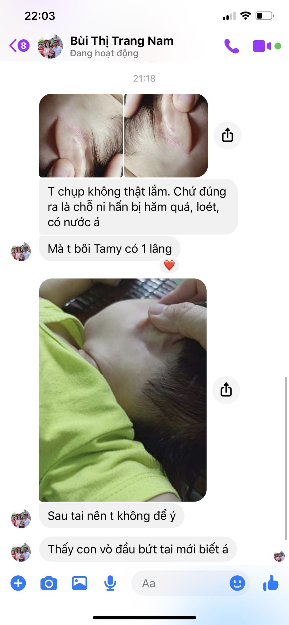 Kem bôi da Tamy