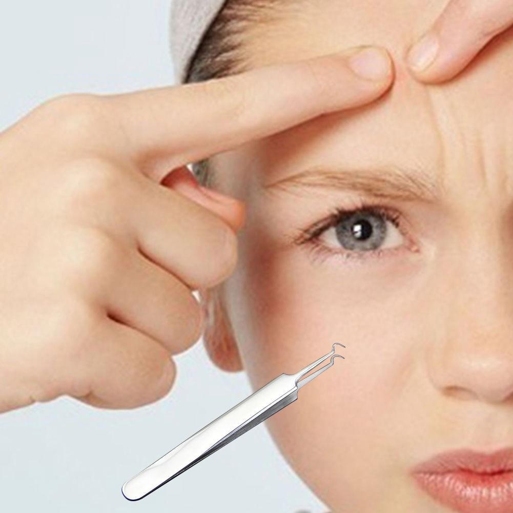 Nhíp gắp mụn đầu cong (8,8cm)