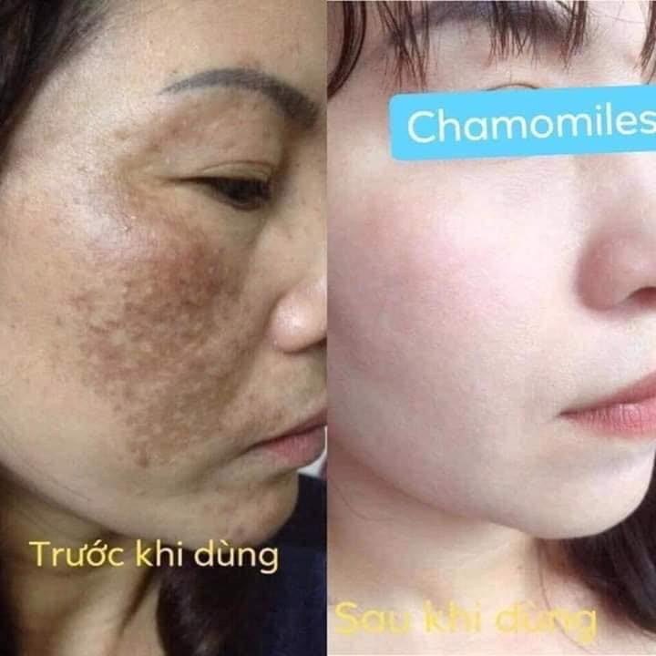[HCM]Combo kem tái tạo Chamomile